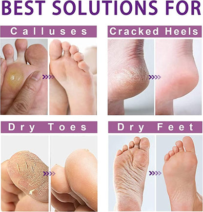 Foot Peel Mask - Exfoliator Peel Off Calluses Dead Skin Callus Remover